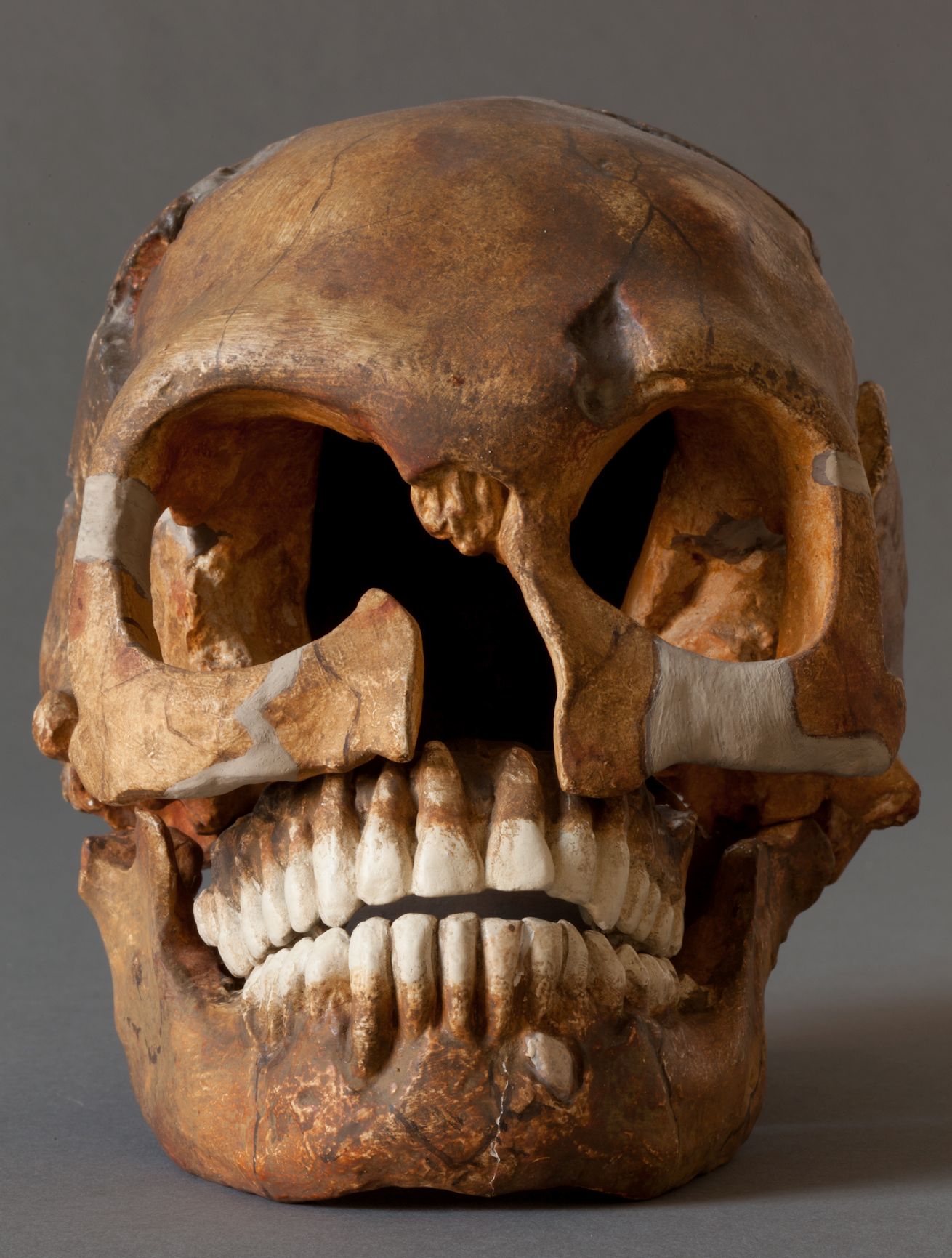 Schädel eines Homo sapiens neanderthalensis, leichte Zerstörungen im Oberkieferbereich